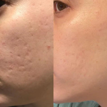 Dermsilk™